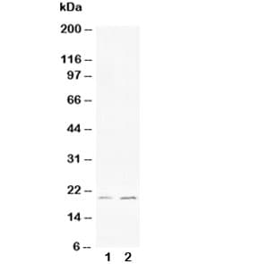 BCL2L1 / BCL-XL Antibody (aa120-130)