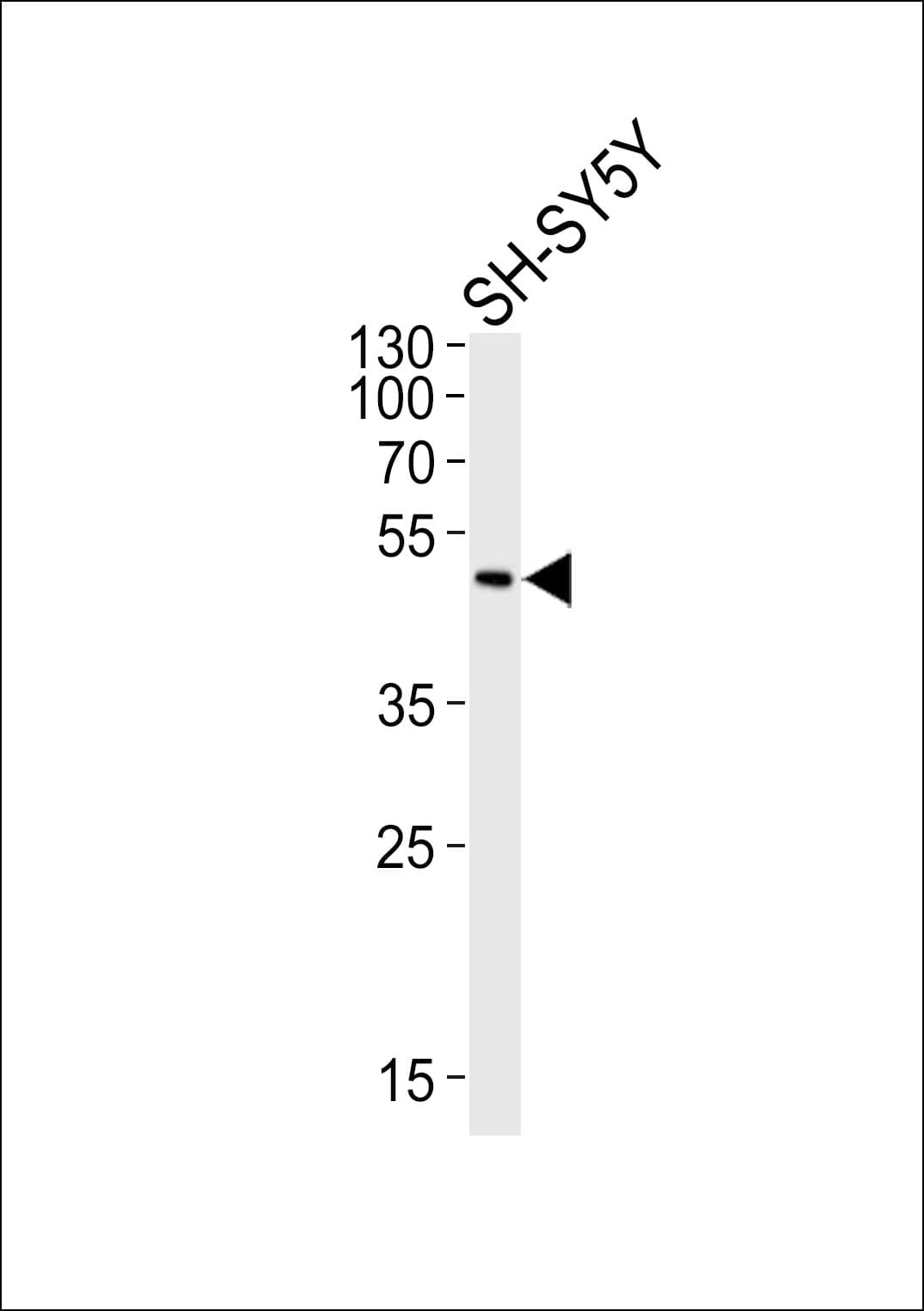 ADORA2A/Adenosine A2A Receptor Antibody (aa347-381)