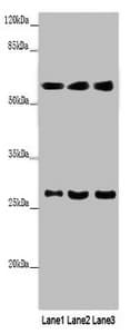 IHC-plus™ Polyclonal Rabbit anti-Human MAOB / Monoamine Oxidase B Antibody (IHC, WB)