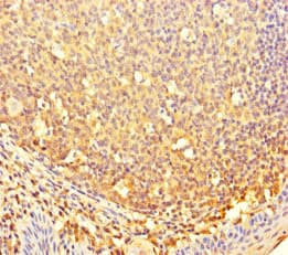 Polyclonal Rabbit anti-Human CBWD2 Antibody