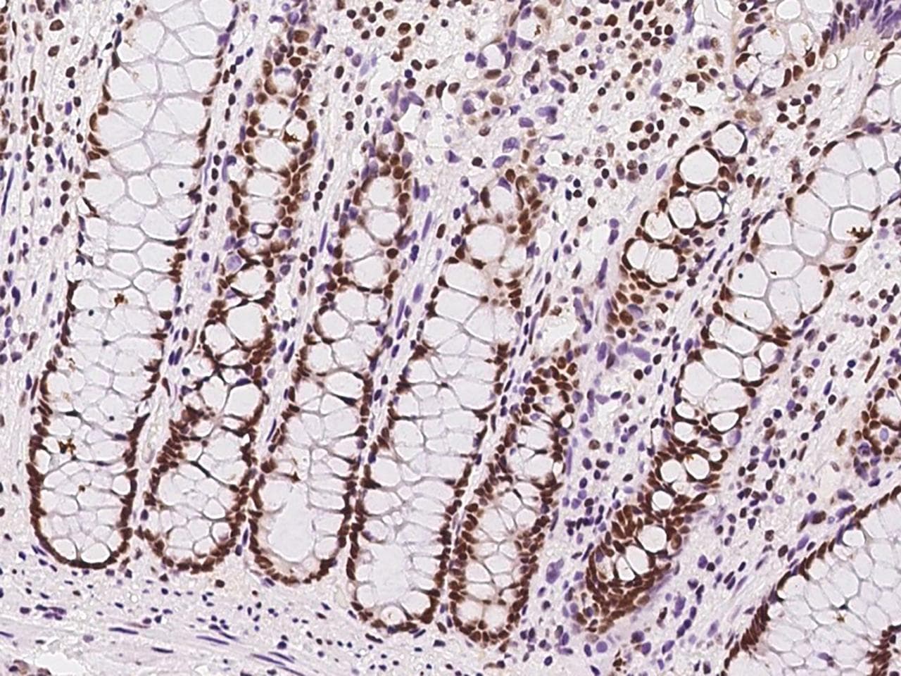 SIN3A Antibody (N-Terminus)
