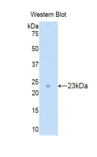CD30L / CD153 Antibody (aa68-231)