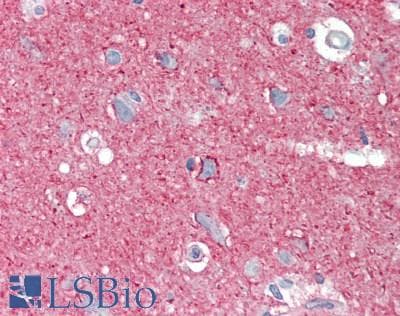IHC-plus™ RAMP3 Antibody