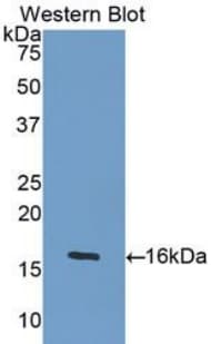GDF5 / GDF-5 Antibody (aa382-501)