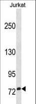 Polyclonal Rabbit anti-Human ZNF274 Antibody (aa53-82, WB)
