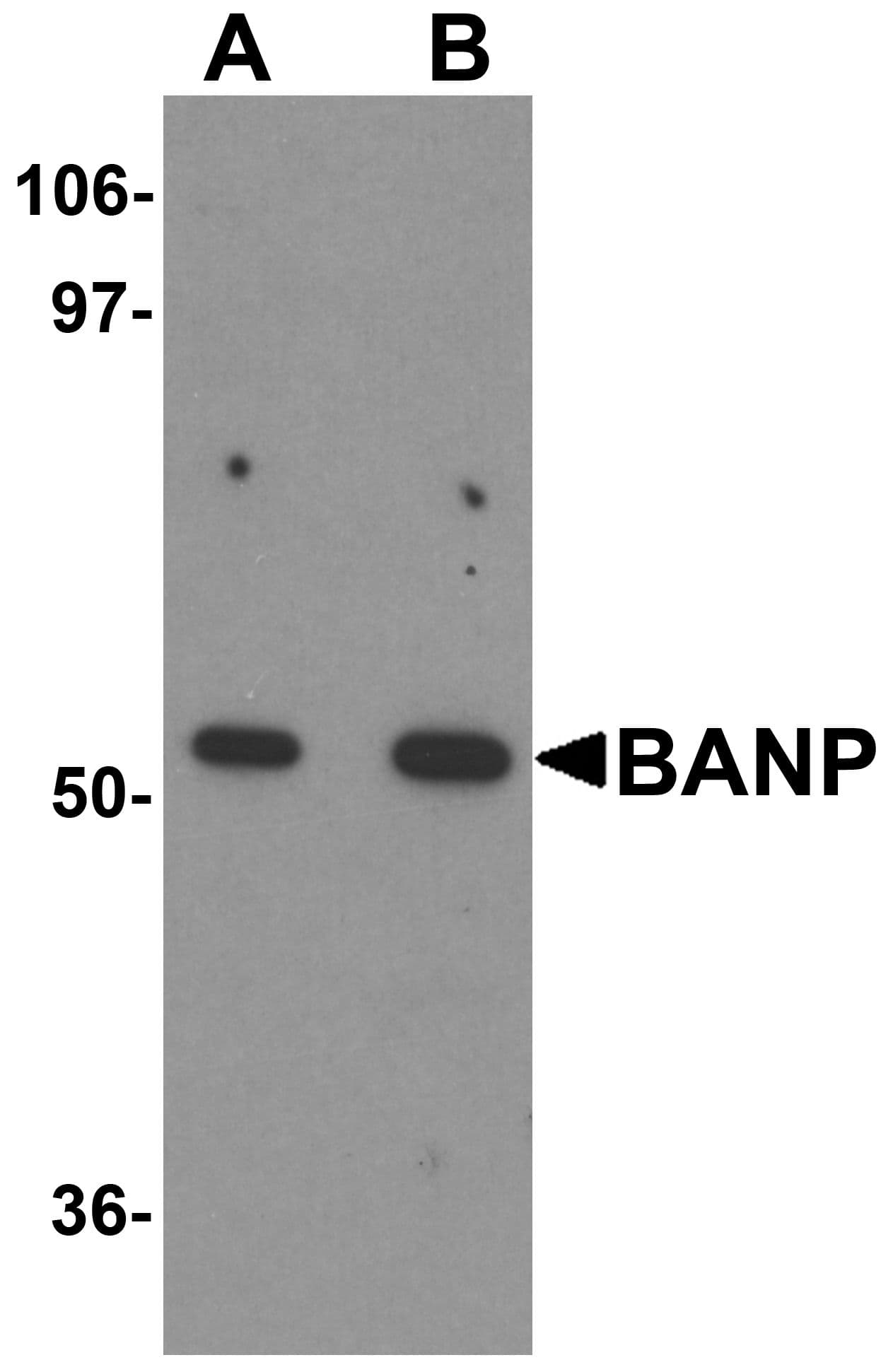 IHC-plus™ BANP Antibody