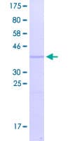 Human KRTAP9-8 Protein (Recombinant GST)