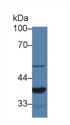 PSIP1 / LEDGF Antibody (aa311-469)