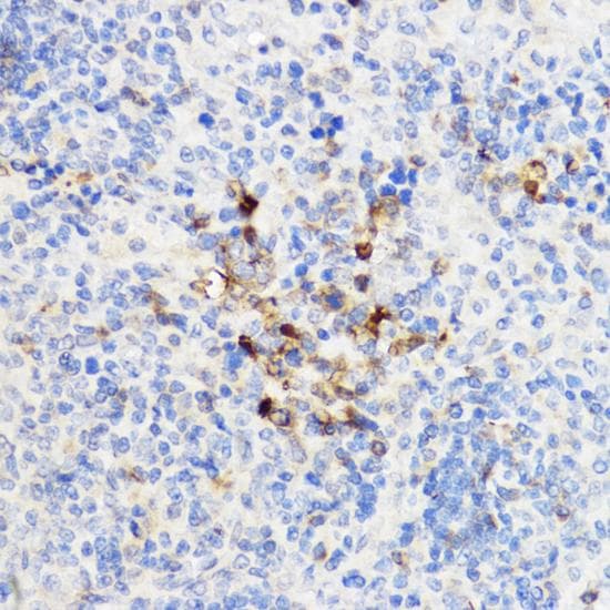Polyclonal Rabbit anti-Human CHI3L1 / YKL-40 Antibody (IHC, IF)