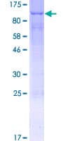 Human ACSL3 Protein (Recombinant GST)