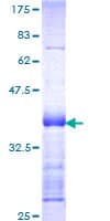 Human STK39 / SPAK Protein (Recombinant GST, N-terminus)
