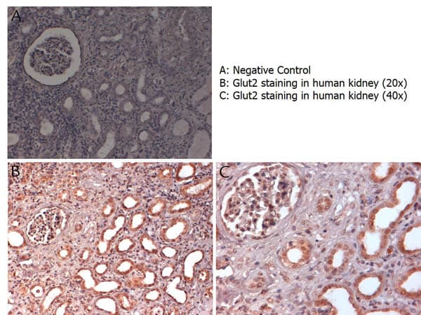 SLC2A2 / GLUT2 Antibody (C-Terminus)