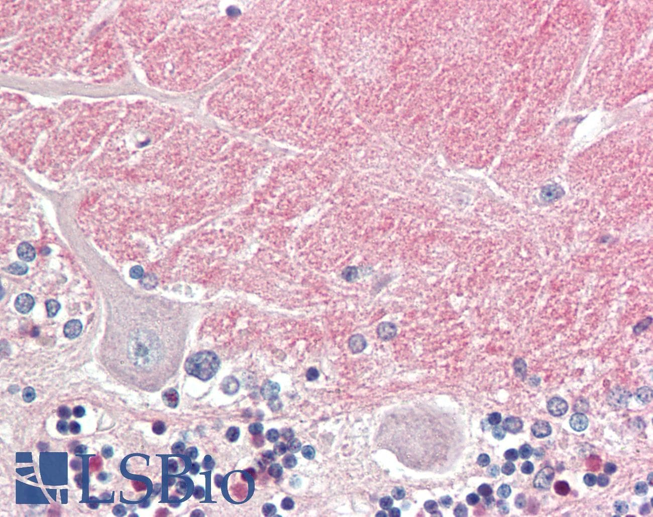 PathPlus™ CNTN1 / gp135 / Contactin 1 Antibody (aa313-324)