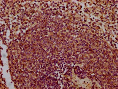 CHODL / Chondrolectin Antibody