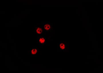 TSC22D1 / TSC22 Antibody