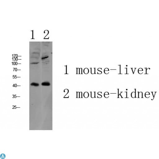 AGTR1 / AT1 Receptor Antibody