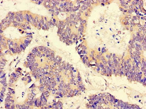 Polyclonal Rabbit anti-Human PGAM5 Antibody (IHC, IF)