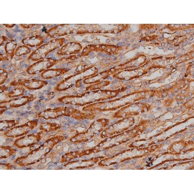 Polyclonal Rabbit anti-Human SP1 Antibody (phospho-Thr739, IHC, IF, WB)