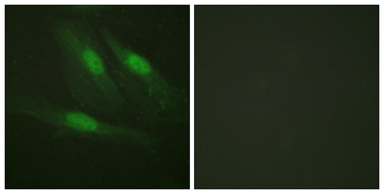 CTNNB1 / Beta Catenin Antibody (p654)