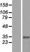 CDYL Protein (Over-Expression Lysate Myc-DDK (Flag))