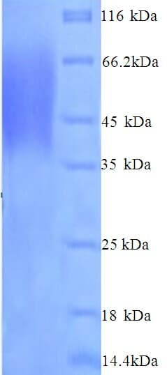 Human NPRA / NPR1 Protein (Recombinant His)