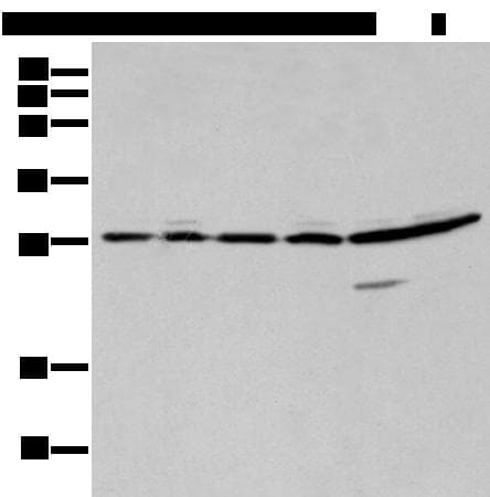 SFN / Stratifin / 14-3-3 Sigma Antibody