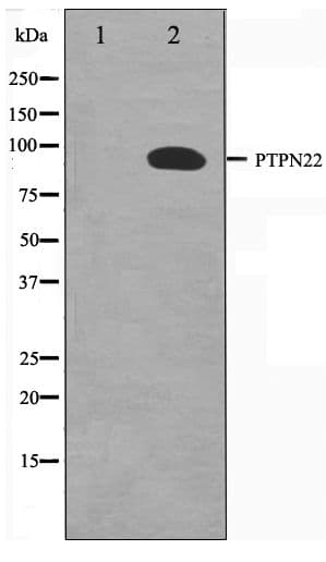 Polyclonal Rabbit anti-Human PTPN22 / PEP Antibody (WB)
