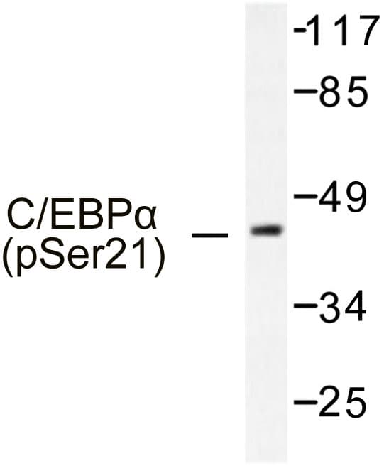 C/EBP Alpha / CEBPA Antibody (phospho-Ser21)