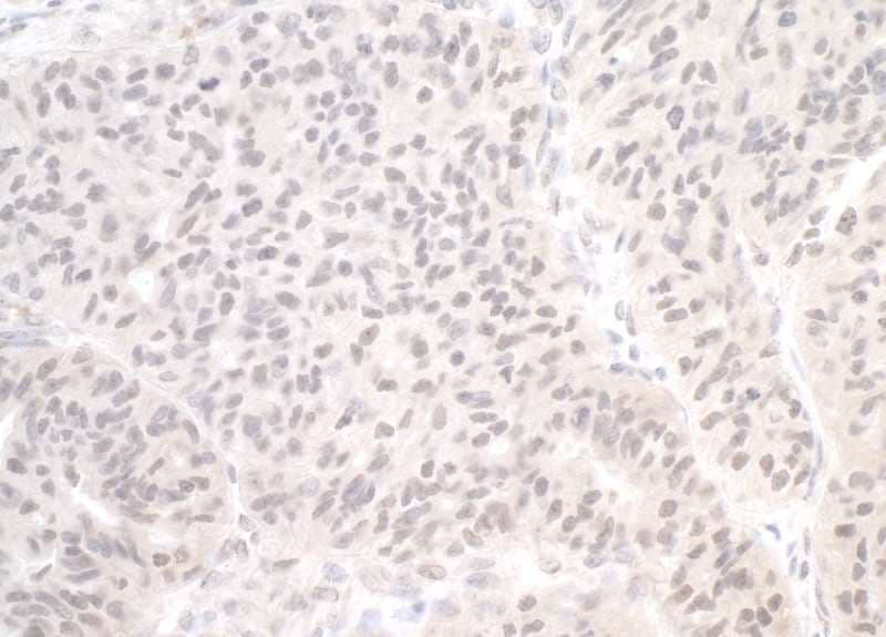 Trimethylguanosine Synthase 1 Antibody (aa150-200)