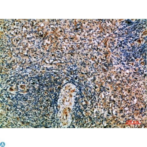 PRF1 / Perforin Antibody