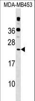 Polyclonal Rabbit anti-Human RPB16 / POLR2D Antibody (aa51-79, WB)