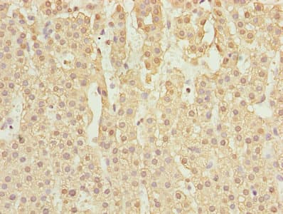 Polyclonal Rabbit anti-Human RASSF5 / RAPL Antibody (IHC, WB)