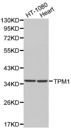 Polyclonal Rabbit anti-Human TPM1 / Tropomyosin Antibody (IHC, WB)