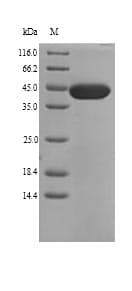 Human COL11A1 / Collagen XI Alpha 1 Protein (Recombinant GST, N-terminus)