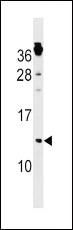CKS1B / CKS1 Antibody (aa3-30)