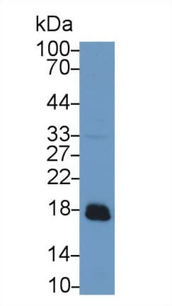 ACP1 / Acid Phosphatase Antibody (aa1-158)