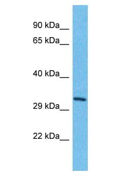 Polyclonal Rabbit anti-Human TMEM202 Antibody (aa212-261, WB)