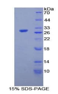Rat PLA2G6 / IPLA2 Protein (Recombinant His-T7)
