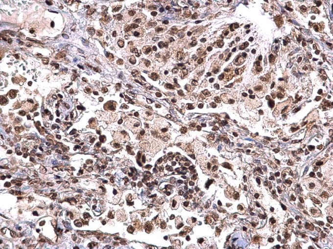 Polyclonal Rabbit anti-Human NPM1 / NPM / Nucleophosmin Antibody (aa1-209, IHC, IF)