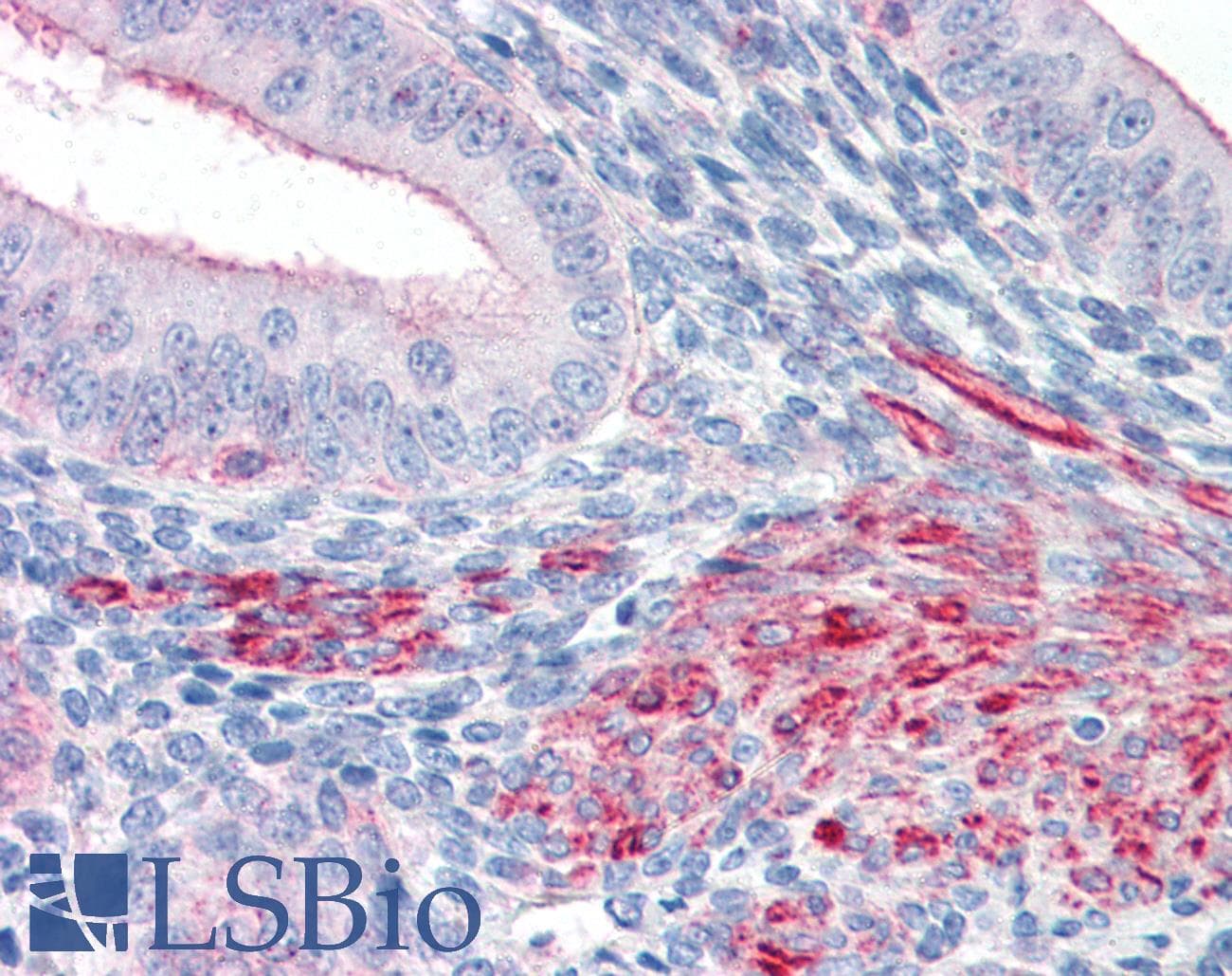 Prostaglandin D Synthase Antibody (aa1-50, Biotin)