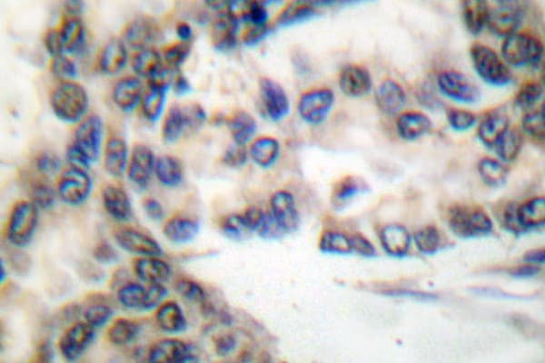 C/EBP Alpha / CEBPA Antibody (Met15)
