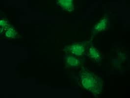 GSTT2 Antibody (clone OTI4F9)