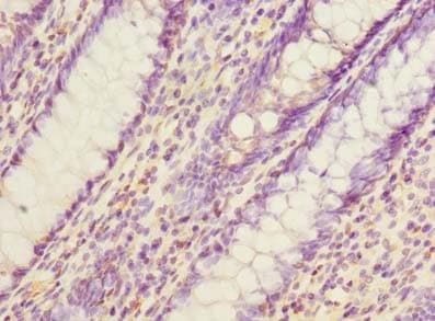EVA1C Antibody
