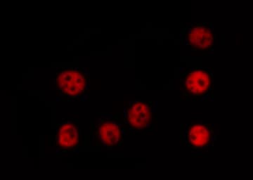 TRIM24 / TIF1 Antibody