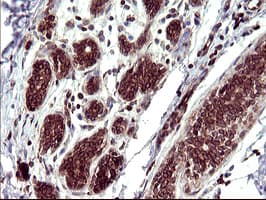 TXNDC1 / TMX1 Antibody (clone OTI1G1)