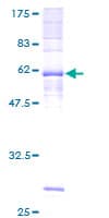 Human Prostaglandin D2 Receptor Protein (Recombinant GST)