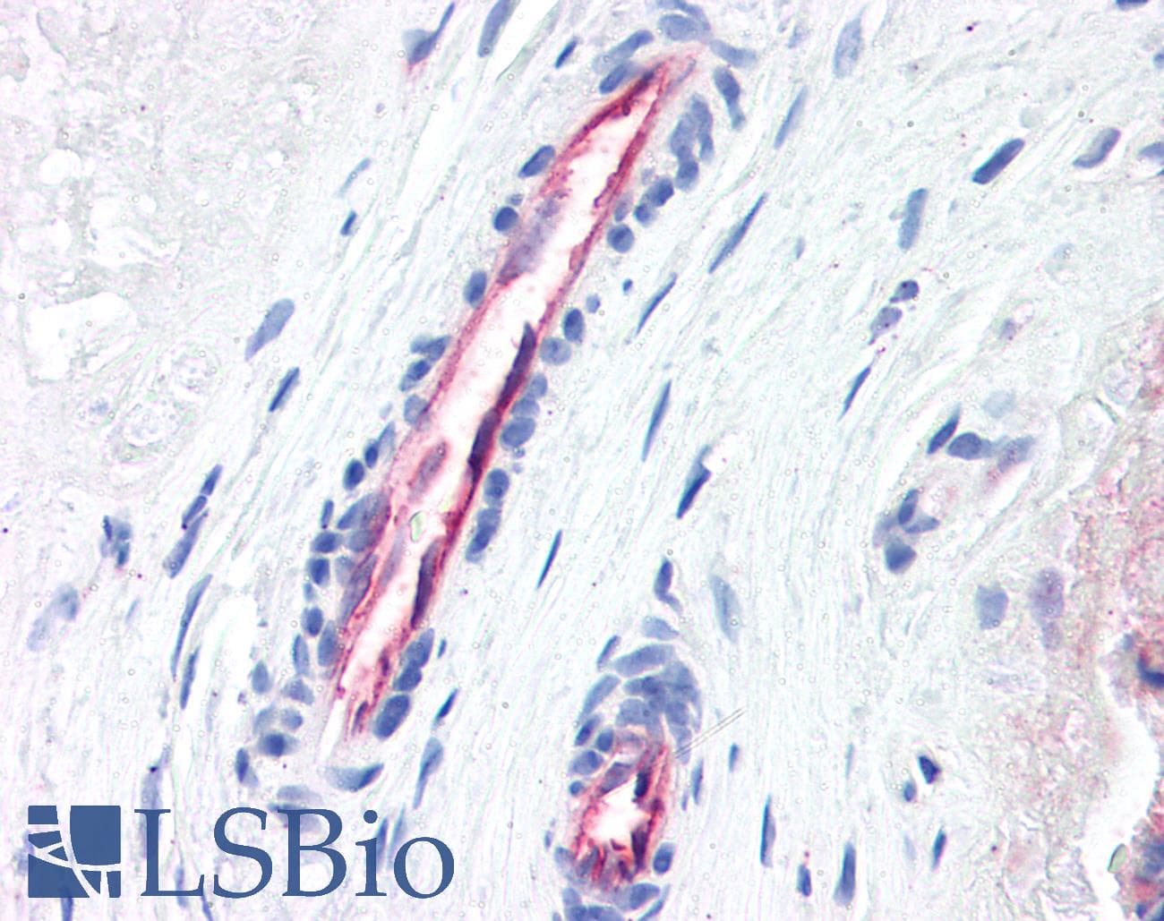 IHC-plus™ Monoclonal Mouse anti-Human F2R / Thrombin Receptor / PAR1 Antibody (clone ATAP2, N-Terminus, IHC, IF)