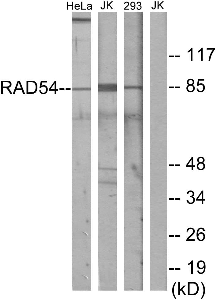 Polyclonal Rabbit anti-Human RAD54L Antibody (aa221-270, WB)