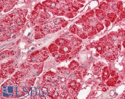 IHC-plus™ ABCC3 / MRP3 Antibody (aa971-1020)