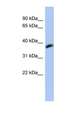 Polyclonal Rabbit anti-Human CYB5RL Antibody (aa71-120, WB)